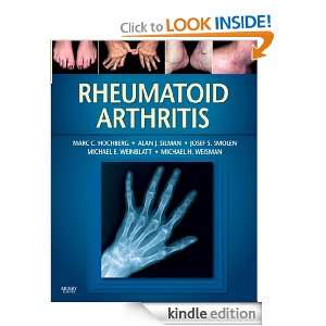Rheumatoid Arthritis Marc C. Hochberg, Alan J. Silman, Josef S 